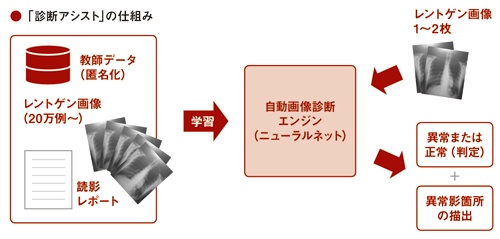 画像を自動診断し、医師の判断を支援する