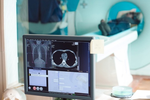 MRI画像を撮影する患者と表示される画像のイメージ（写真提供／Shutterstock）