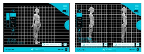 体の 3D スキャンデータ例(左)と、現状と過去のデータの比較例(右)
