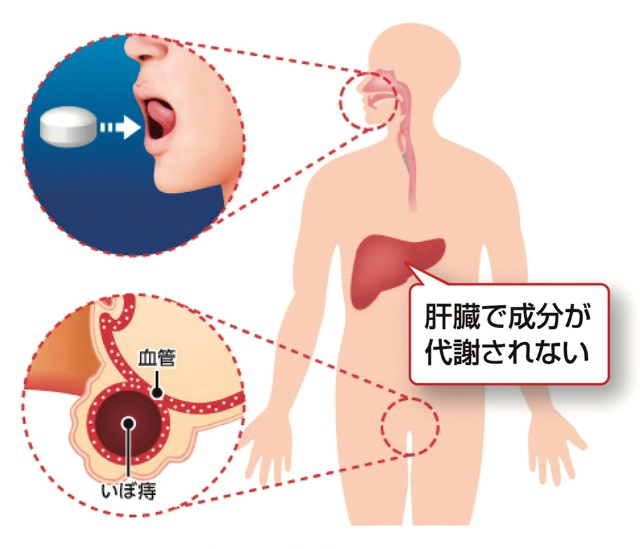 いぼ痔薬 ヘモリンド舌下錠 お尻パッケージで売上高10億円超 日経クロストレンド いぼ痔薬 ヘモリンド舌下錠 お尻パッケージで売上高10億円超 日経クロストレンド
