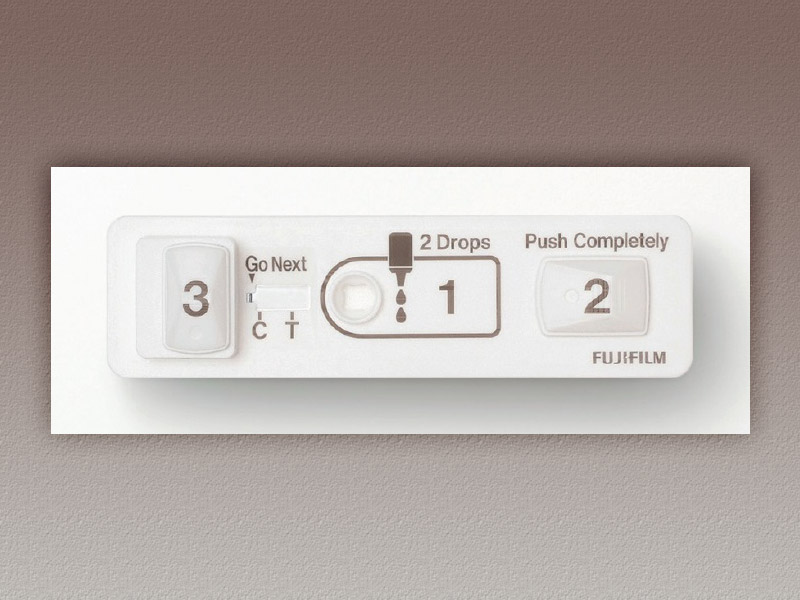 富士フイルムの結核診断キットがグッドデザイン大賞を取れた理由